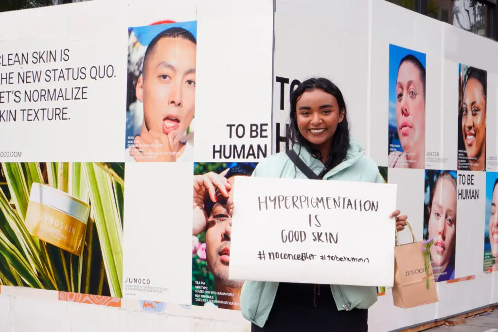 Skin Positivity on display as part of JUNOCO ToBeHuman Campain